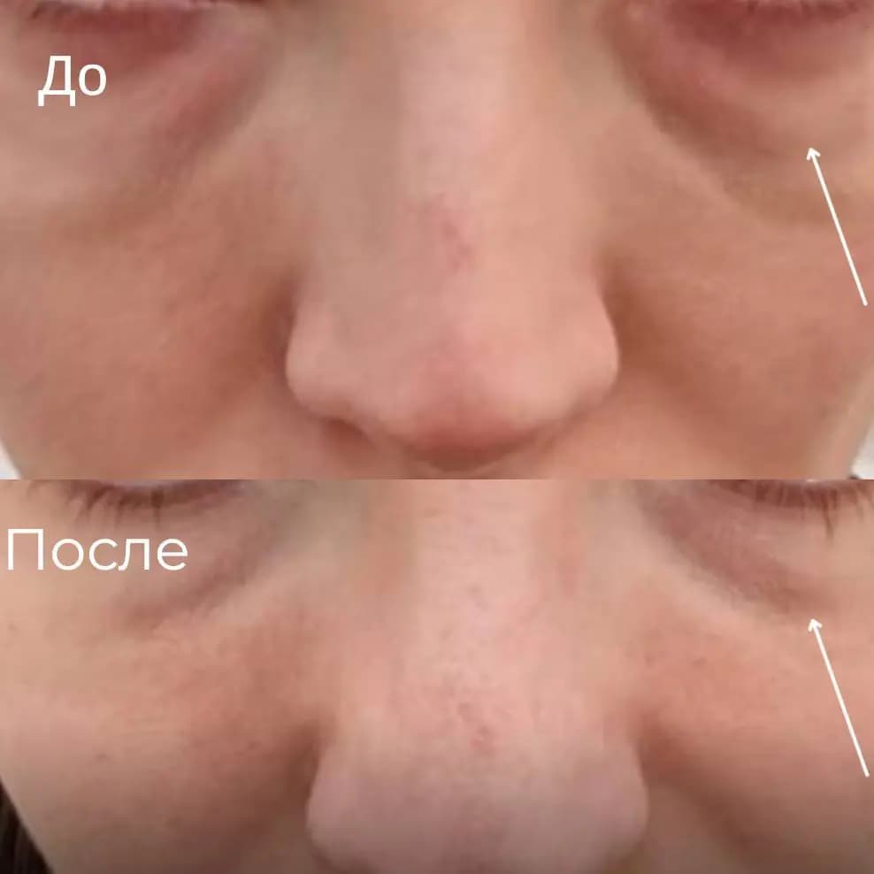 Исправление работы другого врача.