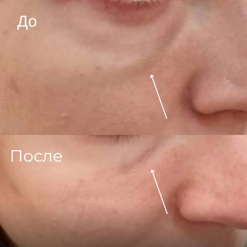 Исправление работы другого врача.