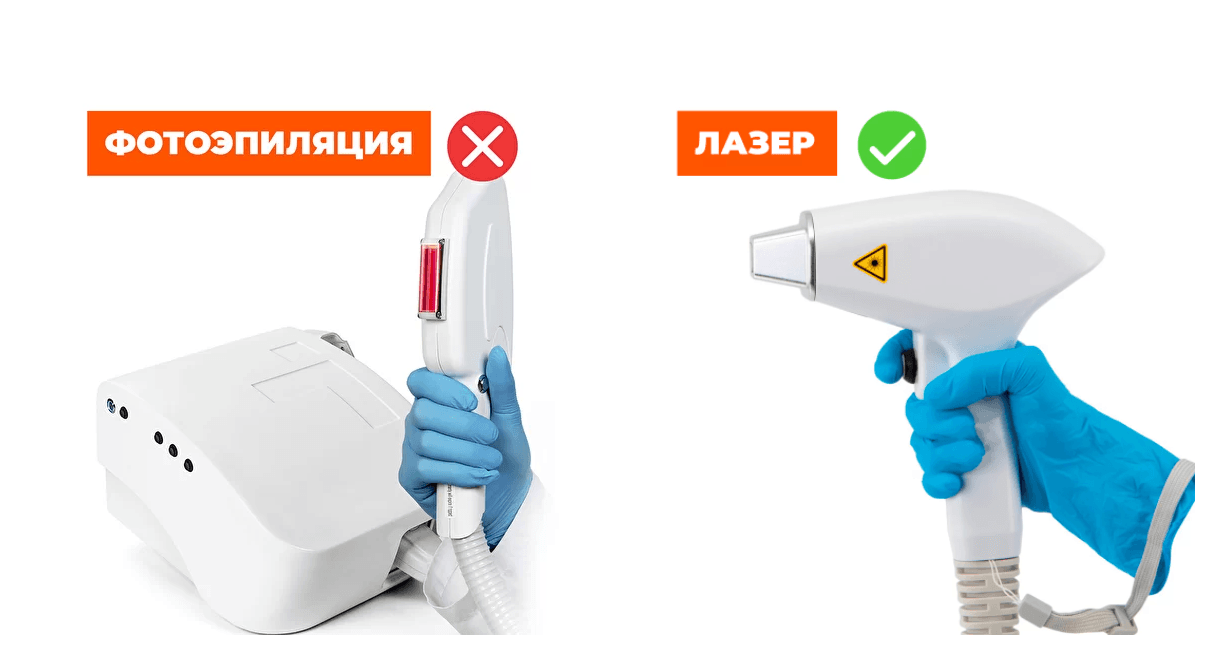 Как отличить лазер от фотоэпилятора? Или почему настоящая лазерная эпиляция не может стоить слишком дёшево